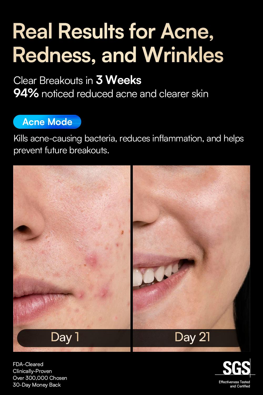 【LIVE EXCLUSIVE】INIA GLOW Wireless LED Face Mask, 2-Year Warranty, Portable and Rechargeable for LED Facial Mask Skincare at Home and Travel, The Ultimate Gift Choice for this Season，Summer Travel Accessories,sohochic